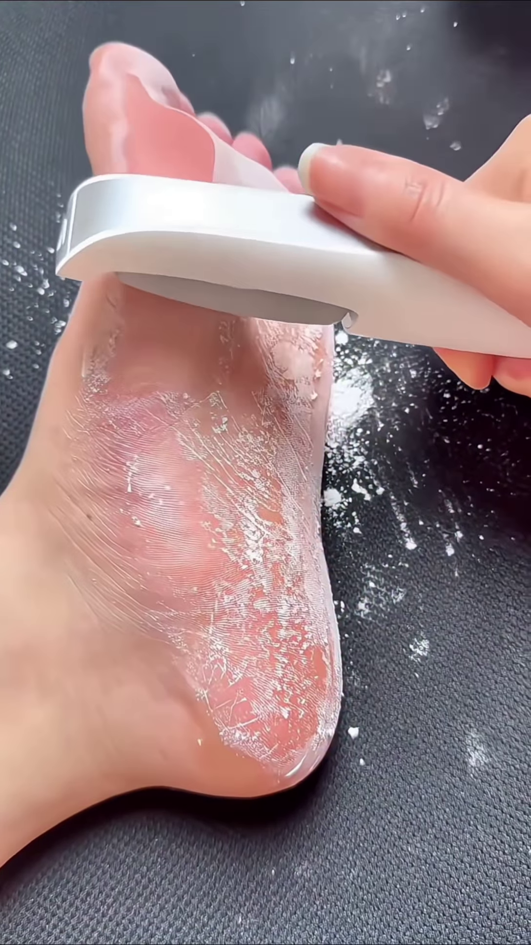 Professional Electronic Foot Scrubber for Smooth Skin Care - Image 4